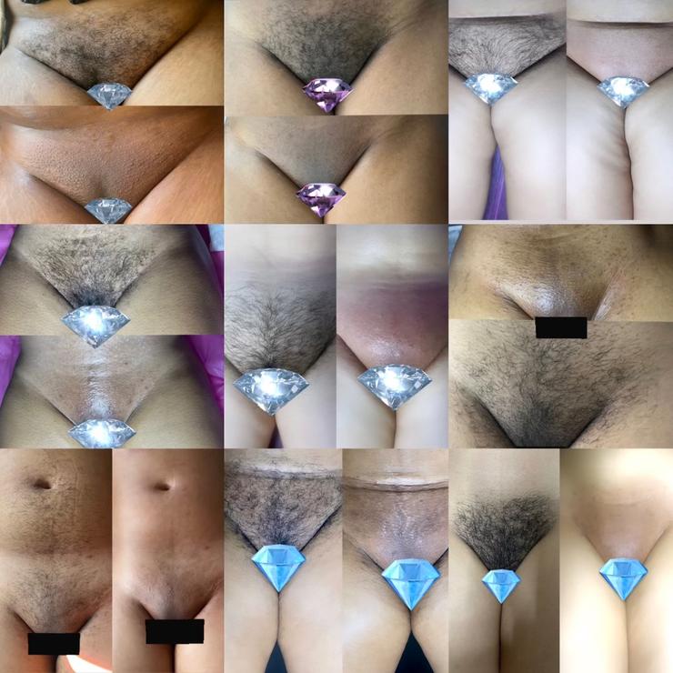 Brazilian Wax